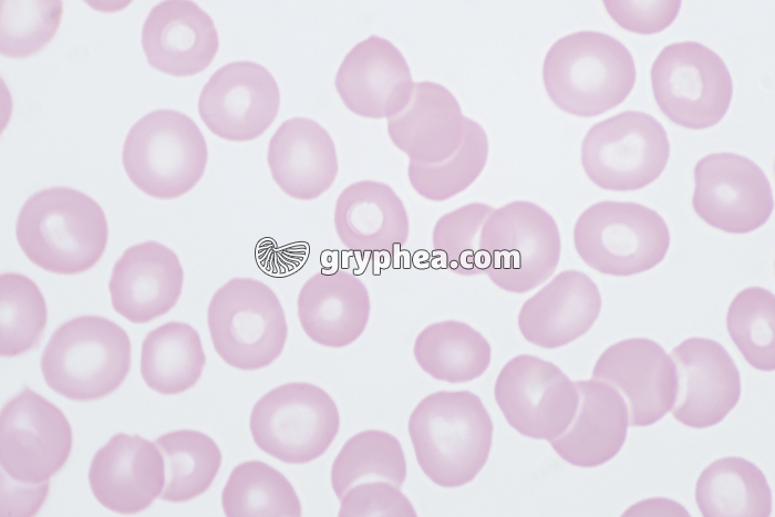 Hématies x640 - gryphea.org